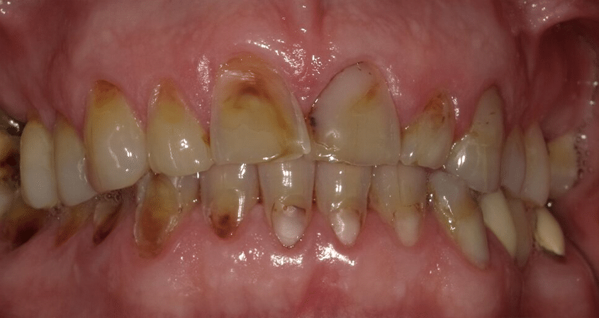 Before